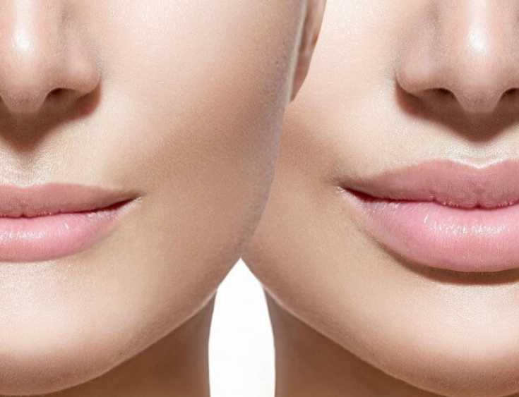 Ученые назвали форму женских губ, которую мужчины предпочитают больше всех