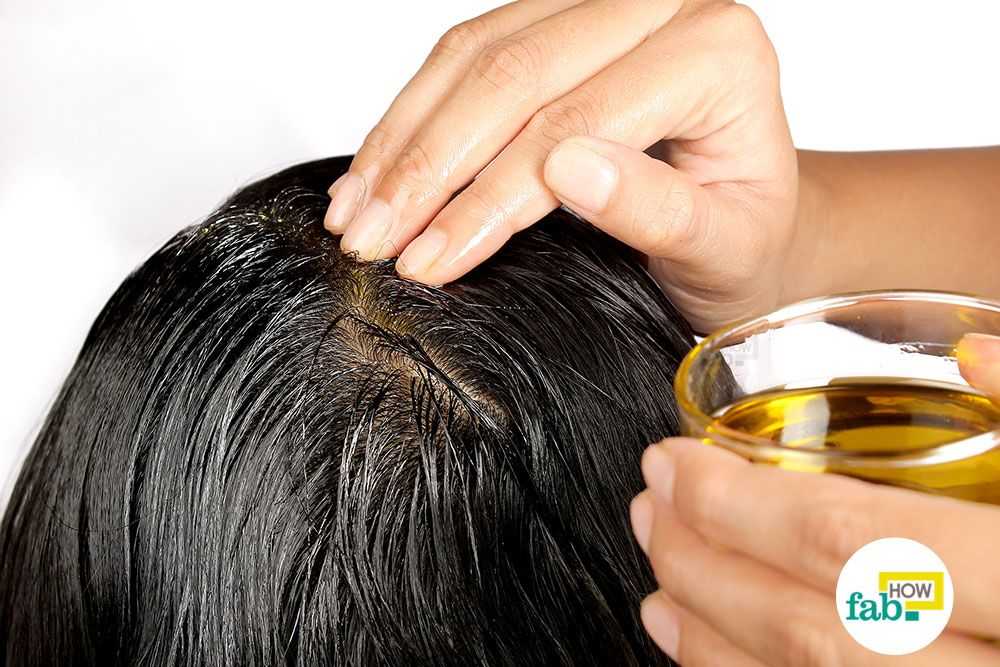 Народные лечение выпадения волос очагов
