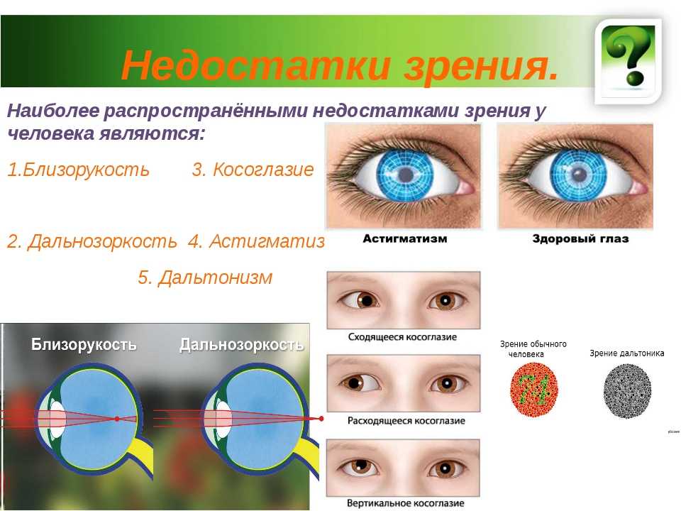 Можно ли изменить цвет глаз хирургическим путем? «ochkov.net»