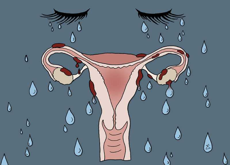 Месячные (менструация)