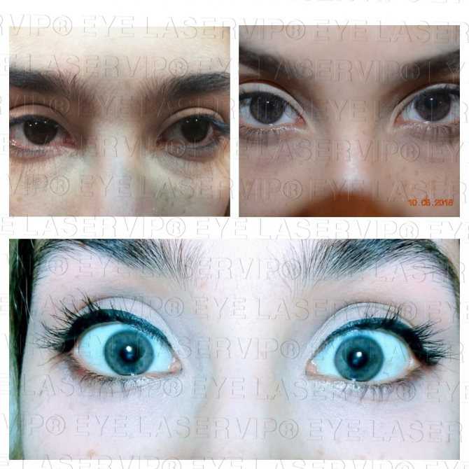 Голубые глаза: происхождение и генетика голубых глаз